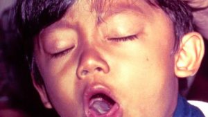 La difteria es una epidemia que se extiende