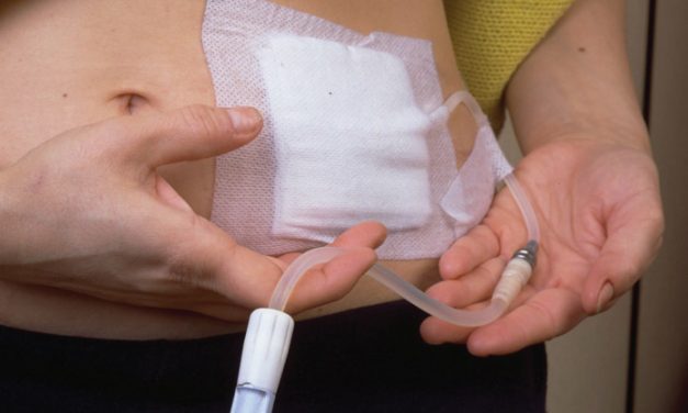 Miles de personas en peligro ante la ausencia de insumos para Diálisis Peritoneal