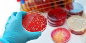 OPS informa de 40 muertes por Difteria en los primeros cuatro meses del 2018