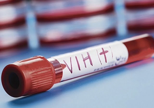 Acovih exige al ministro de Salud medicamentos para personas con VIH y SIDA